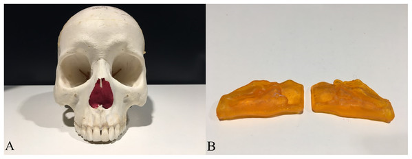 The human skull and the 3D printed hollow nasal airway model embedded in with playdough.