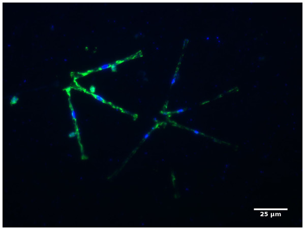 Micrographs showing Cryptomycota cells (targeted with the LKM11-01 probe, Mangot et al. 2009) attached to the diatom Asterionella (21/05/2015 Aydat lake, France).