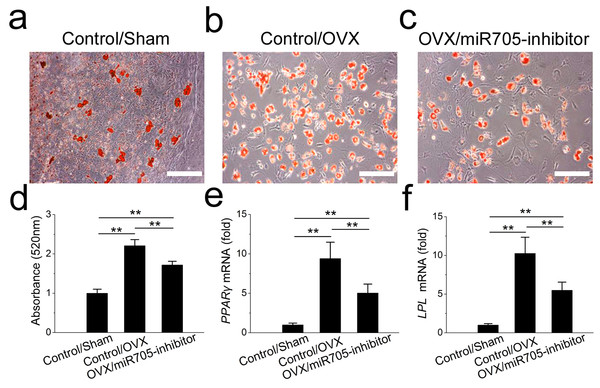 Knockdown of miR-705 inhibits adipogenic differentiation of OVX MSCs.