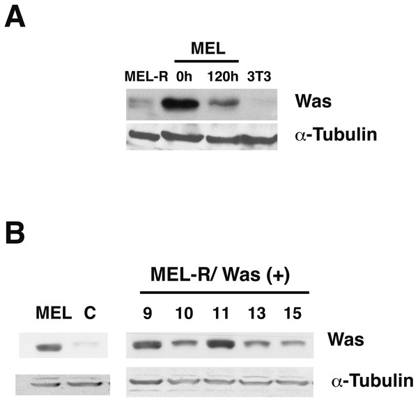 WASp is poorly expressed in MEL-R cells.