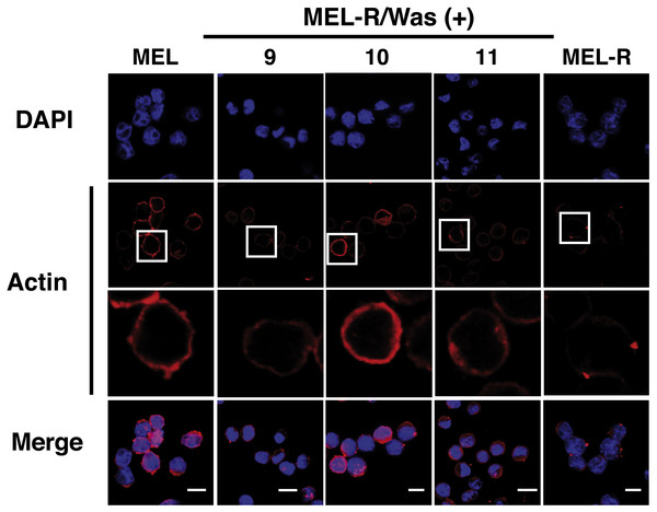 Overexpression of Was. induces organization and polymerization of actin cytoskeleton in MEL-R cells.