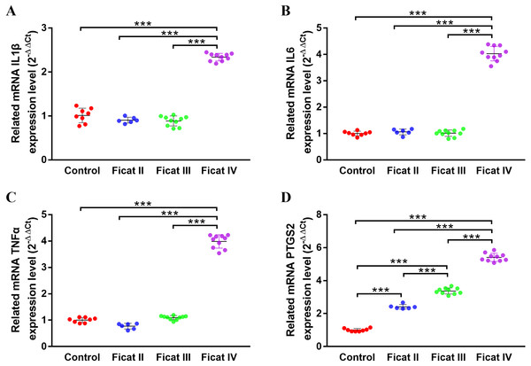 The gene expression levels of arthritis-related genes in cartilage specimens with different Ficat stages.