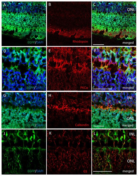 Immunostaining of each retinal cell type of AAV-DJ intravitreally injected mouse retina.