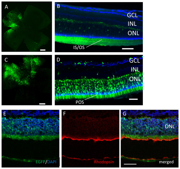EGFP transfection into the murine retina with subretinal injection of AAV-DJ vector.