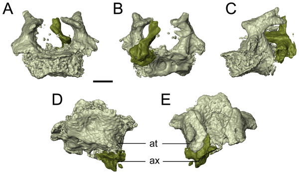Selected profiles of the atlas-axis complex of referred specimen of Llistrofus pricei (OMNH 79031).