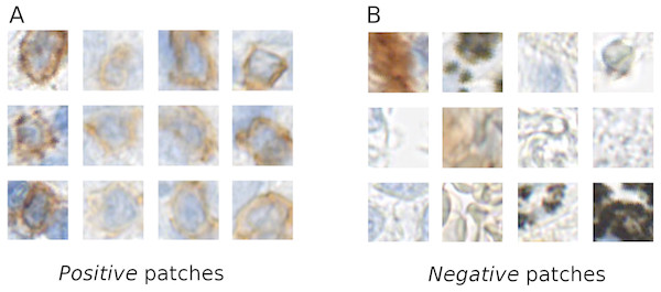 Example of the positive (A) and negative (B) patches of a training image set.