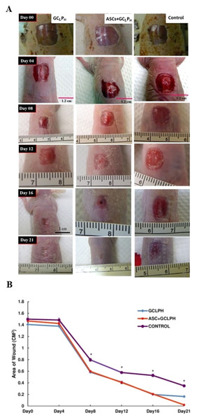 Comparison of wound closure: (A) the appearance and (B) the area of wound in the full-thickness skin defect of nude mice covered with GCLPH scaffold and those seeded with ASCs until 21 days.