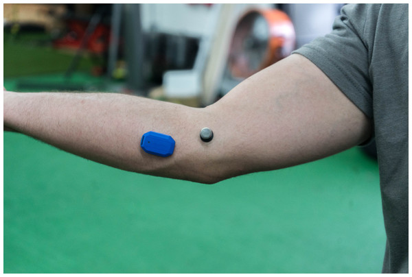 Placement of the motusBASEBALL sensor on the elbow.