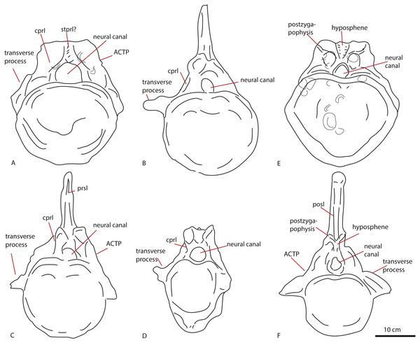 Comparative schematic drawings of PETMG R272 with anterior caudals of other sauropods.