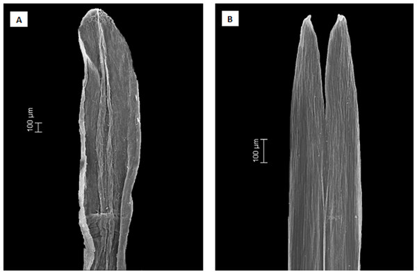 Scanning electron microscopy images showing the differences in anther apical appendages.
