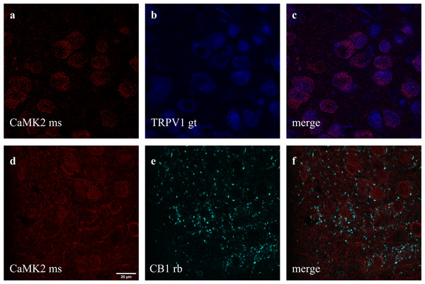Co-staining of (A–C) CaMK2 (from mouse - ms) and TRPV1 (from goat - gt), and (D–F) CaMK2 and CB1 (from rabbit - rb) in prelimbic area of prefrontal cortex in mice.