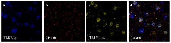 Co-staining of (a) TRKB (from goat - gt), (b) CB1 and (c) TRPV1 (from mouse - ms) in prelimbic area of prefrontal cortex in mice.