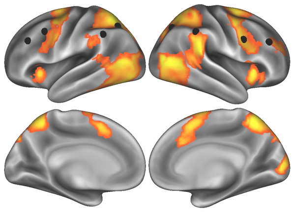 Task-elicited brain activity related to effortful self-control, with eight nodes comprising the frontoparietal control network (Power et al., 2011) indicated by black spheres.