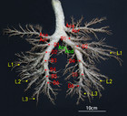 The distributive and structural characteristics of bronchus-associated ...