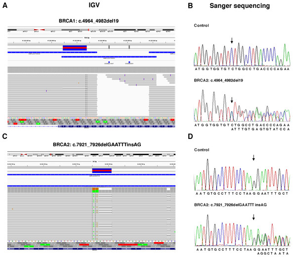 Representative image of read alignments showing the germline mutations of BRCA1 and BRCA2 detected by NGS analysis after minimal adjustments in the analytical pipeline of Torrent Suite Software.