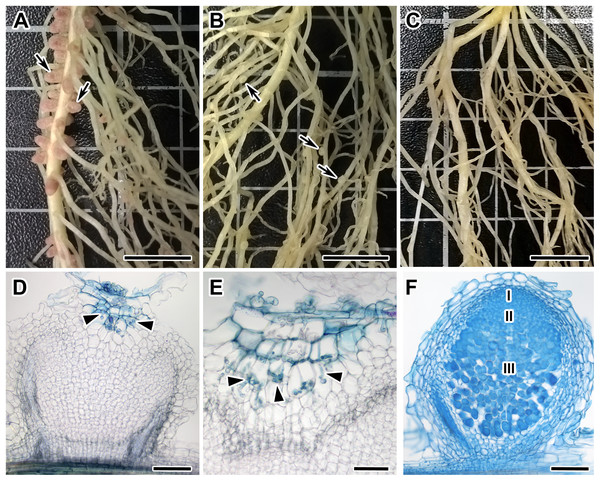 Root systems of segregants with Nod +Fix+ and Nod +Fix− phenotypes from F2(NGB1238 × N24) and mutant N24 (sym11) and histological organization of formed nodules.