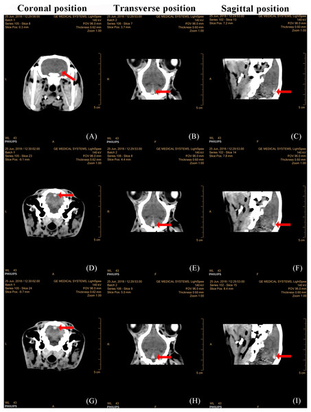 CT images of three serial layers and three sections in group 2, 1 h after injury by a 650 kPa impact.
