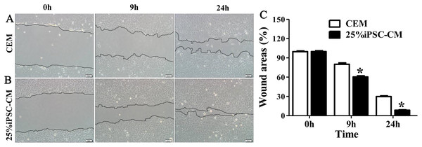 Effect of iPSC-CM on the migration of B-CECs.