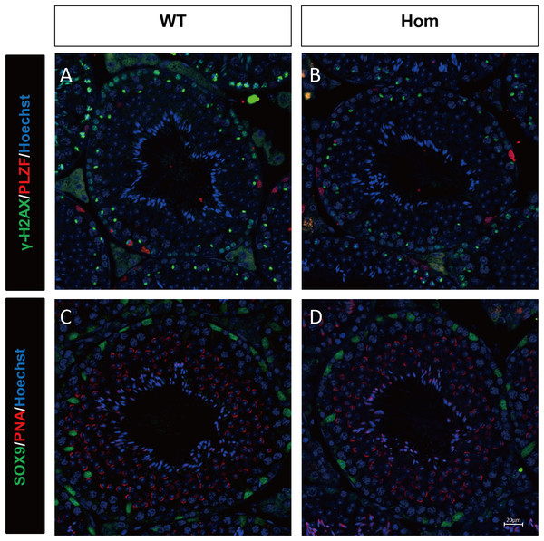 Spermatogenic markers appear normal in Fank1−/− mice.