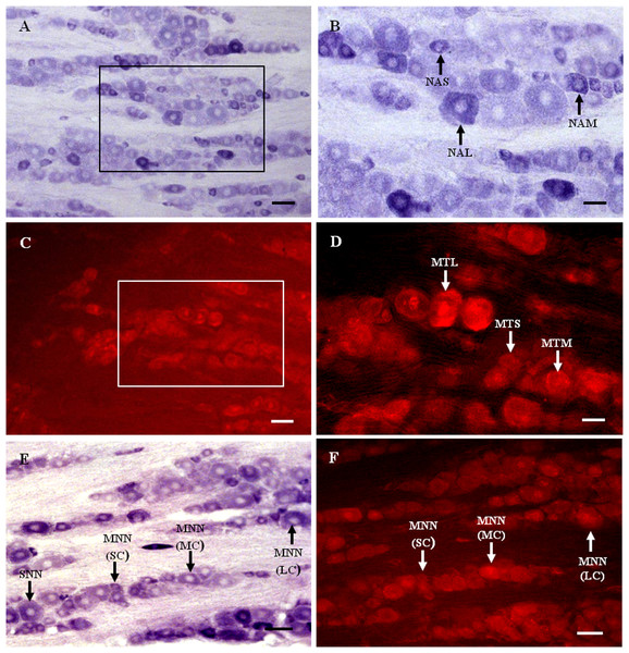 MT1 distribution and colocalization with NADPH-d in TG neurons.