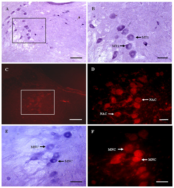 MT1 distribution and colocalization with NADPH-d in MTN neurons.