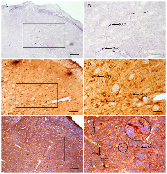 MT1 distribution and colocalization with NADPH-d in STN neurons.