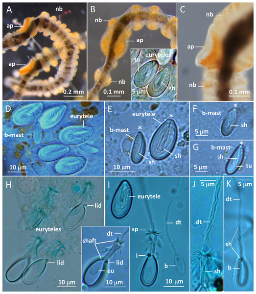Gonionemus sp. Micromorphology of tentacles and nematocysts.