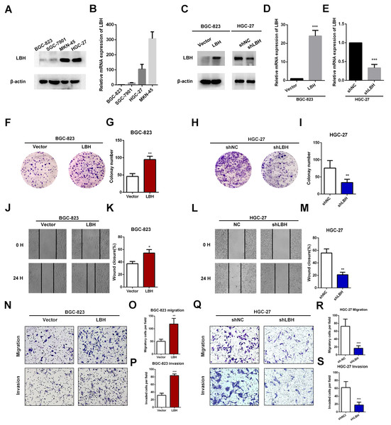 LBH promoted the gastric cancer cell proliferation, migration and invasion.