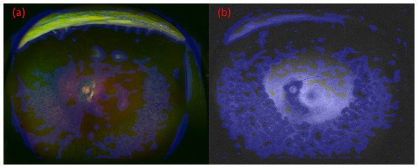 The images and their heatmaps of (A) ultrawide-field pseudocolor (UWPC). (B) Ultrawide-field autofluorescence (UWAF).