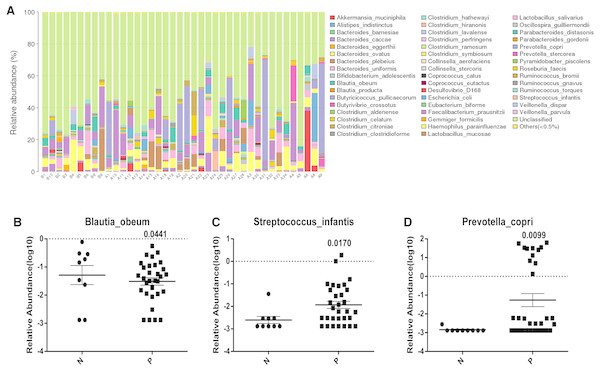 Analysis of the variation of intestinal gut in species level incontrols and Acute Cerebral Infarction patients.