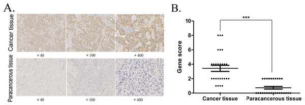 IHC detection of P5CR1 protein expression.