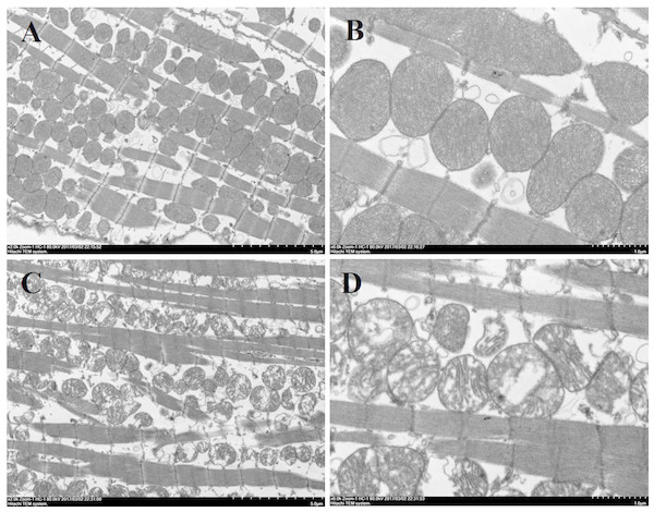 Ultrastructure of myocardial mitochondrial in transmission electron microscopy.