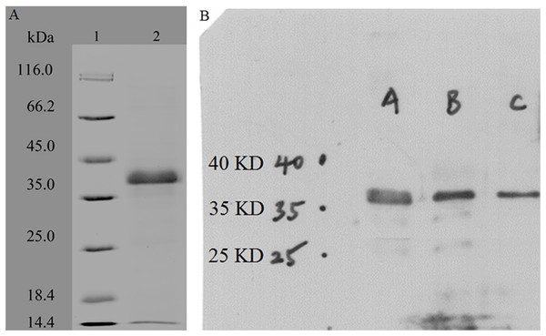 SDS-PAGE and Western blotting analysis of the purified recombinant Rpf-1.