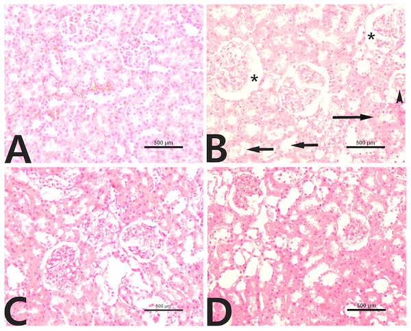 Renal histopathology in male rats after administration of CCl4 and/or rutin.