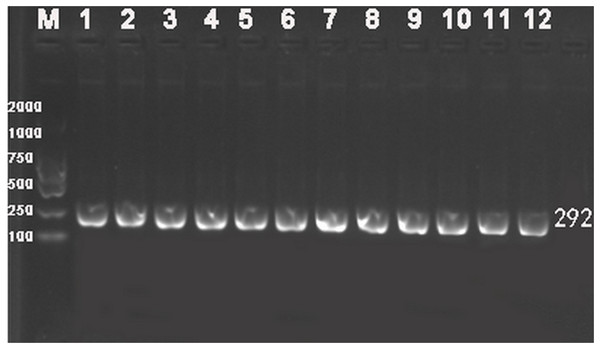 Representative electrophoresis gel of PCR for VDR FokI (rs2228570) polymorphism.