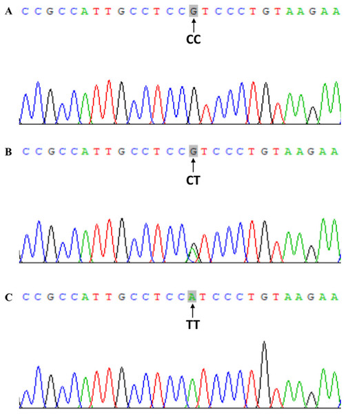 Chromatograms of direct sequencing for VDR FokI (rs2228570) polymorphism.