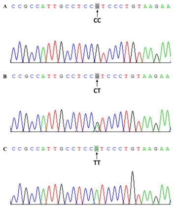 Association between VDR gene FokI polymorphism and renal function in ...