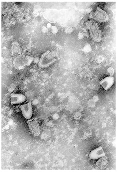 Infectious hematopoietic necrosis virus (IHNV) viewed under a transmission electron microscope.