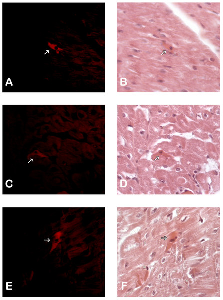 Adipose Stem Cells in the myocardium of MI+ASC heart group. (A, C and E) Fluorescence Microscopy Celltracker Dil 400 ×; (B, D, and F) Hematoxylin-eosin, 400 ×.