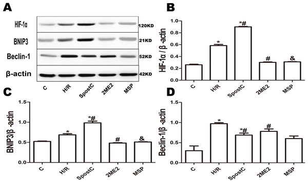 Effect of SpostC on HIF-1α, BNIP3 and Beclin-1 protein expression after H/R injury.