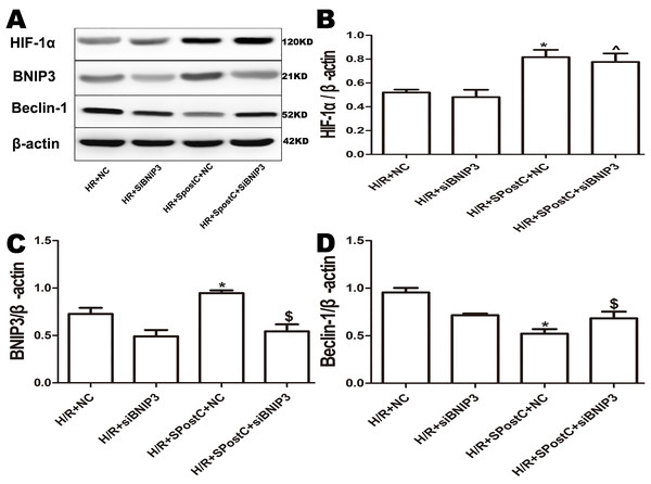 Expression of HIF-1α, BNIP3 and Beclin-1 protein in each group after silencing of BNIP3.