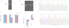 Identification of microRNA-21 target genes associated with hair ...