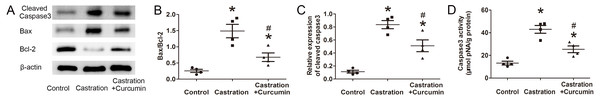 Apoptosis in seminal vesicle.