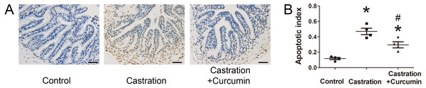 TUNEL staining and apoptotic index.