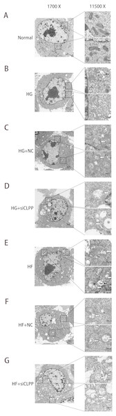 Representative TEM images of mitochondrial ultrastructure at the indicated conditions (A–G).