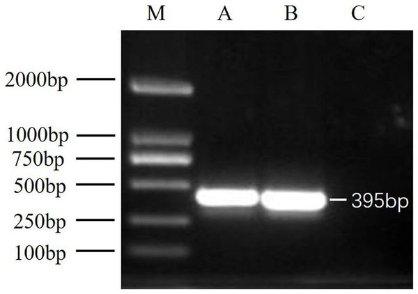 RT-PCR detection results.