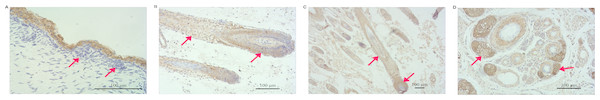 Distribution of VDR immunoreactivity in fetal goat skin.