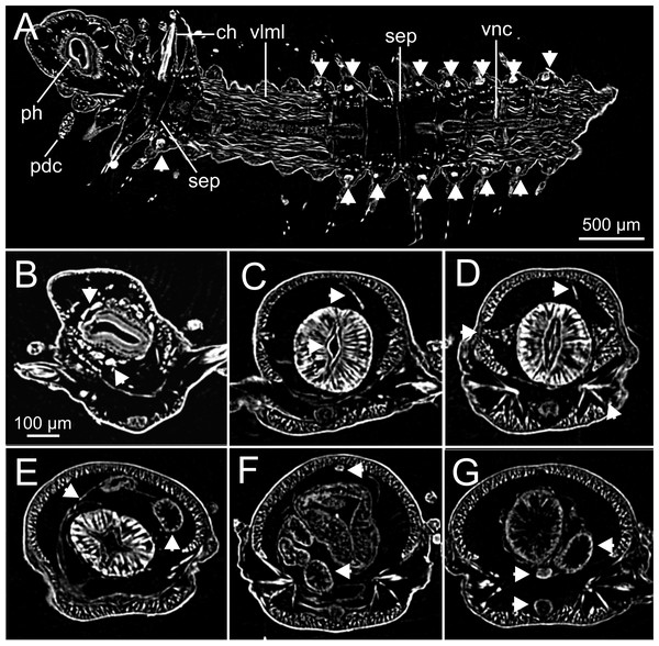Micro-CT 2D images of internal anatomy of Syllis gracilis.