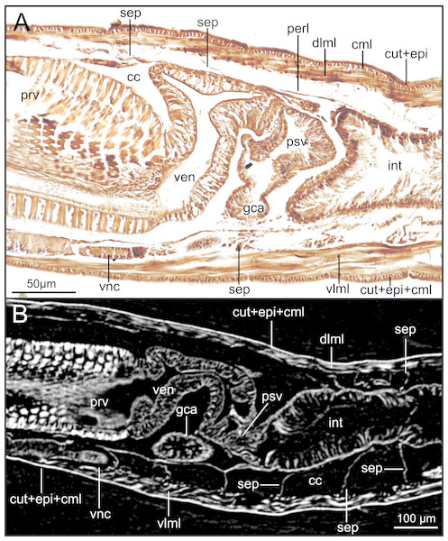 Comparison of images of proventricle-ventricle-intestine region of Syllis gracilis.