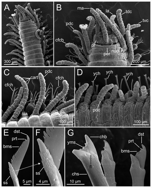 SEM micrographs of Syllis gracilis.